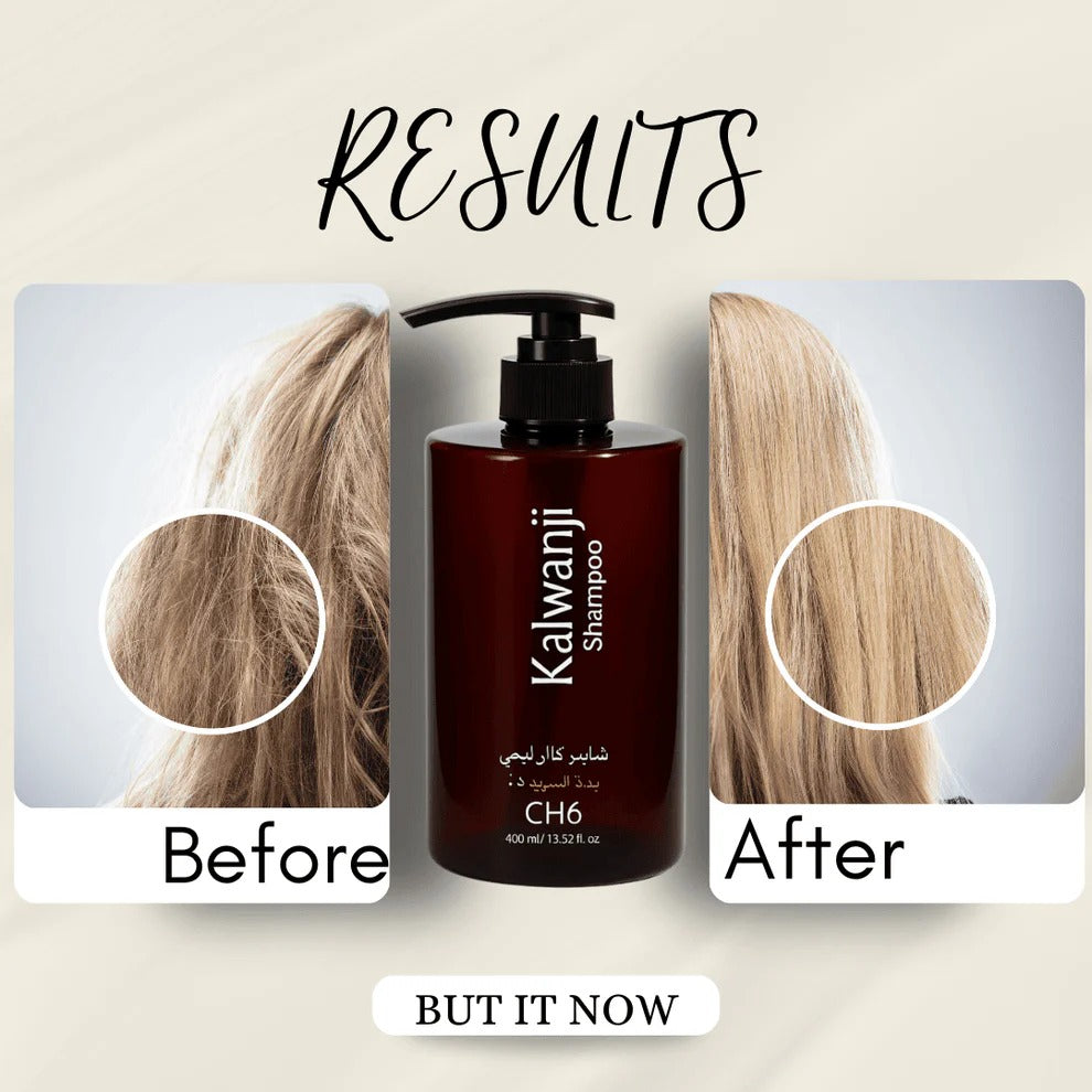 Organic Kalwanji Black Seed Shampoo 400ml – Rawaaj 🌿