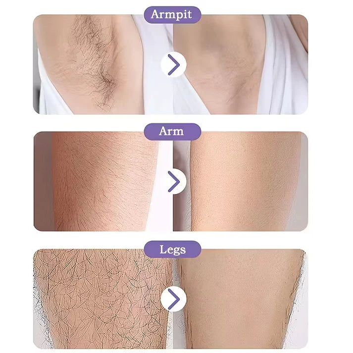 Crystal Hair Removal — Smooth Skin Without Pain